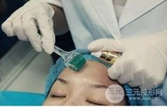 微针美容的大概费用，缓解真的很恐怖吗?