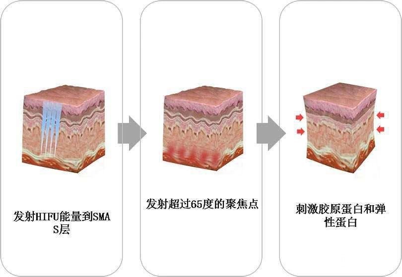 热拉提