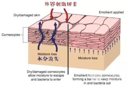 来了！你的敏感皮肤“自救”指南