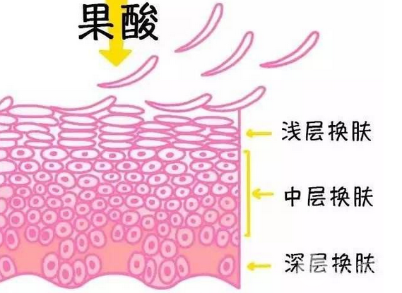 果酸换肤是什么