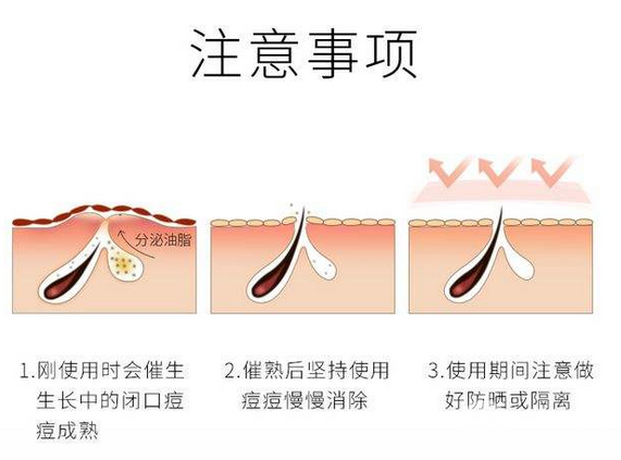 果酸换肤是什么