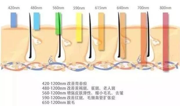 脉冲光(光子美白嫩肤)