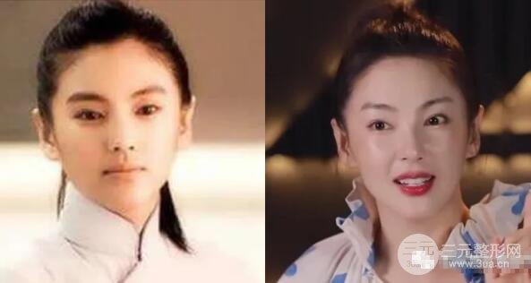 姐姐抗衰方法大揭密|激光+注射,紧肤塑形有道理!