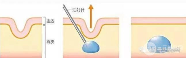 胶原蛋白