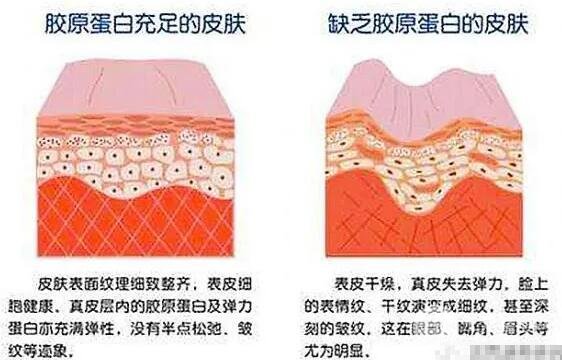胶原蛋白