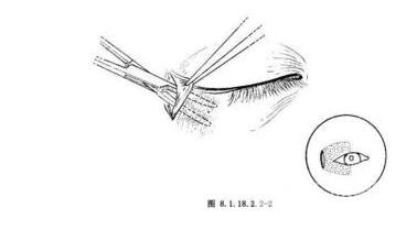 这里有一份更官方的介绍：
