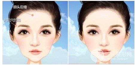 面部填充大概多少钱
