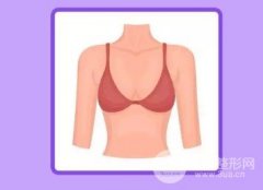 副乳怎么减？先分清真假副乳再说~
