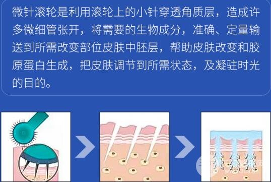 水光的四种缓解方式
