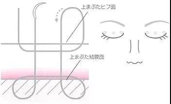 日本*医志|二十年如一日，专注埋线双眼皮的整形大师~