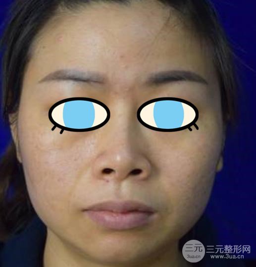 日本*医志|精益求精，鼻部修复大师横山才也~