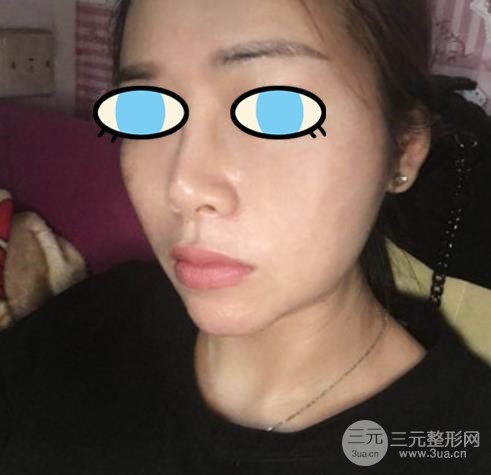 日本*医志|精益求精，鼻部修复大师横山才也~