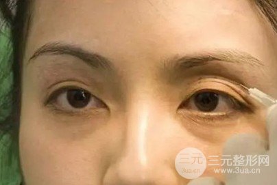 眼部暗沉是什么原因
