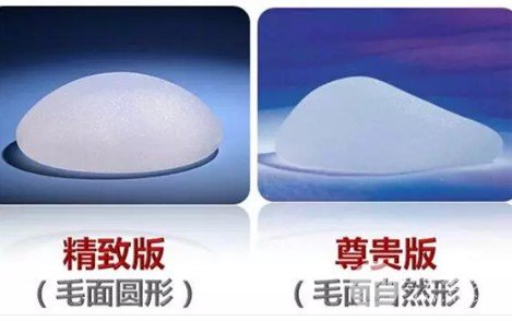 麦格娜绮丽假体隆胸果好