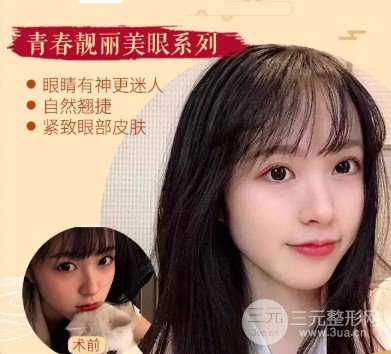 开外眼角前后对比