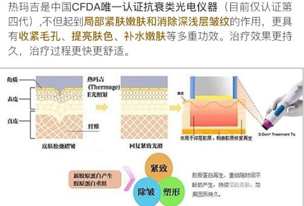 热玛吉的缓解时间