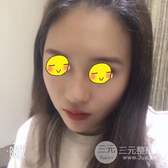 武汉三医院整形美容科案例分享