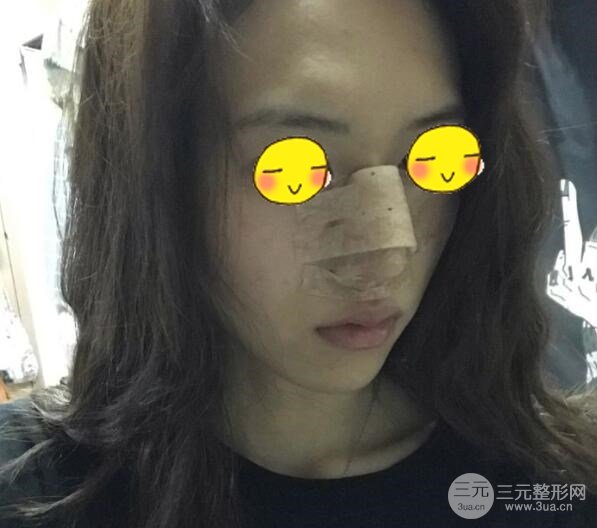 武汉三医院整形美容科案例分享