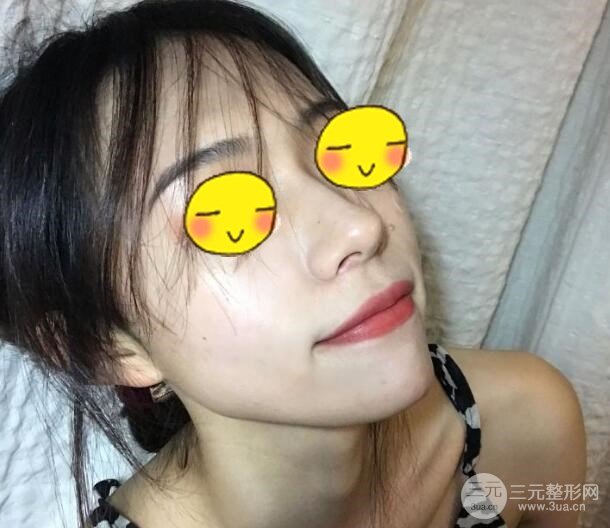 武汉三医院整形美容科案例分享