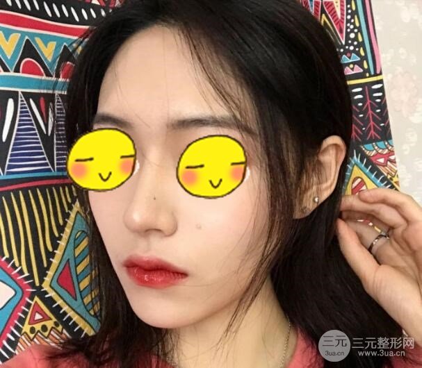 武汉三医院整形美容科案例分享