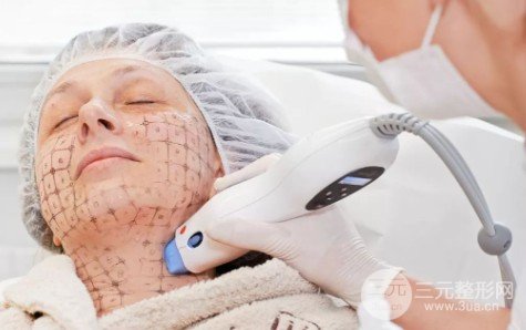 做热玛吉有什么后遗症