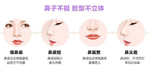 硅胶隆鼻整形手术
