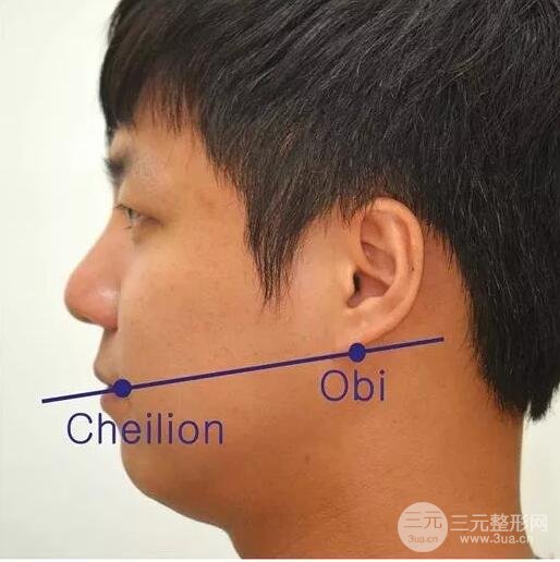 超声检验