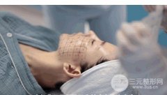 做完热玛吉脸失败图片，还有可能变方脸!