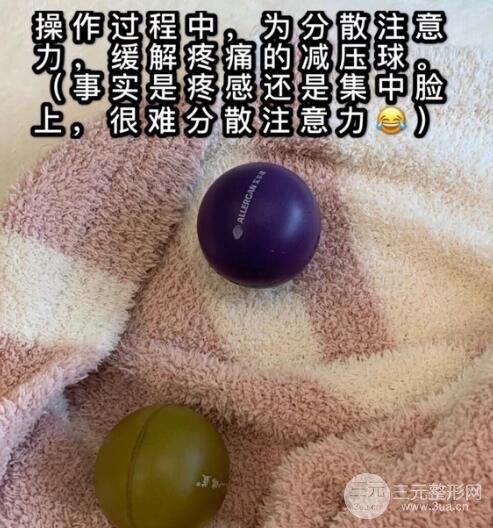 做热玛吉眼部去皱疼吗?
