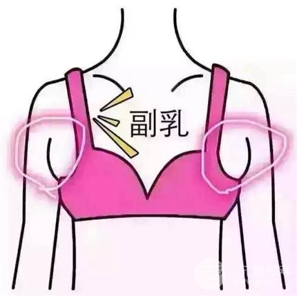 【科普】副乳切除手术几天恢复?手术注意事项~
