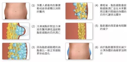 怎么样溶脂吸脂