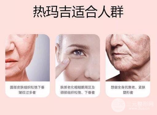 热玛吉手术有哪些朋友可以做?