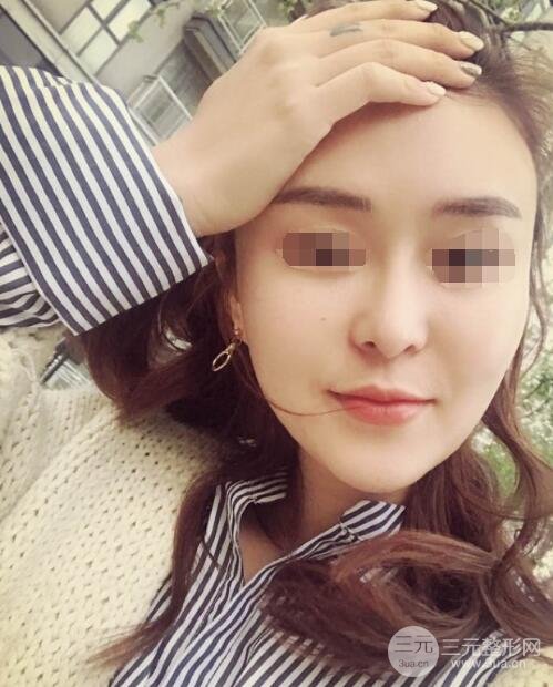 体验热玛吉果反馈