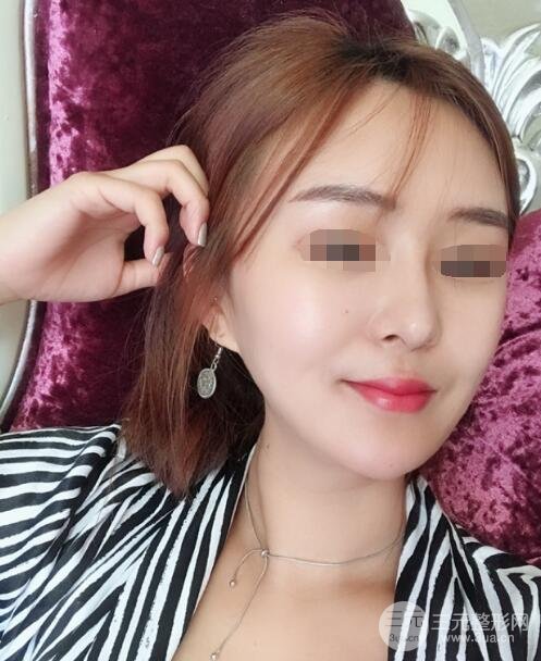 体验热玛吉果反馈