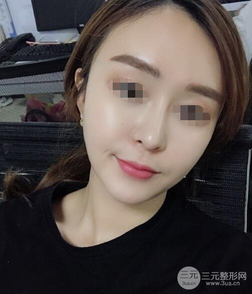 体验热玛吉果反馈