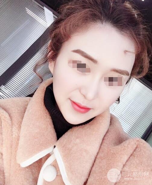 体验热玛吉果反馈