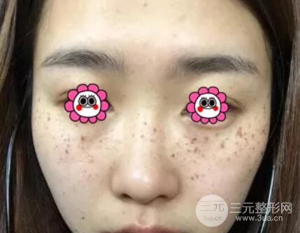 成功案例