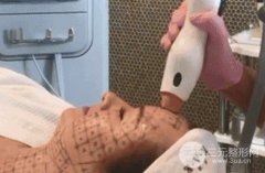 热玛吉四代做了会有哪些果？哪里有来自正规渠道热玛吉?