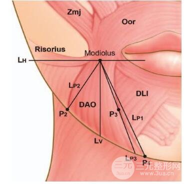 图4 降口角肌的较准解剖位置评估