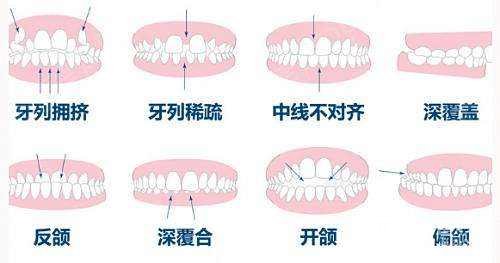 牙齿问题
