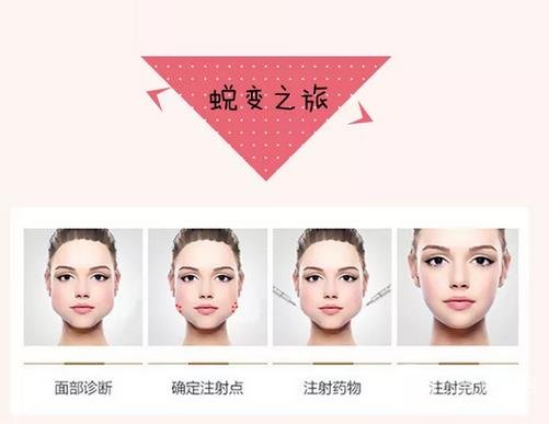 注射注射瘦脸后的护理方法
