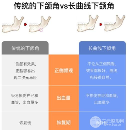 下颌角长曲线截骨