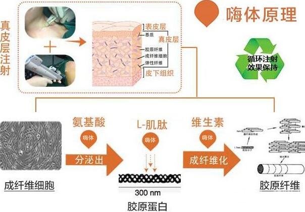 嗨体颈部注射除皱有木有降低风险风险