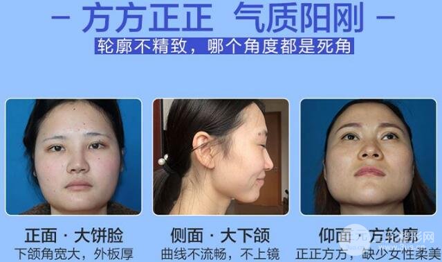 下颌角手术价格