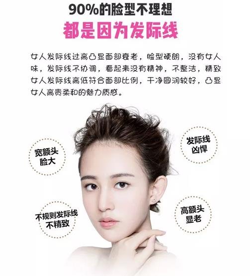 发际线种植