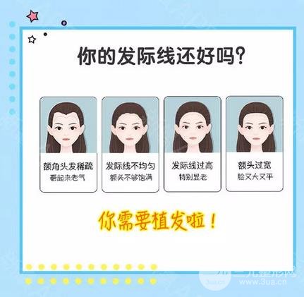 植发际线有什么危害