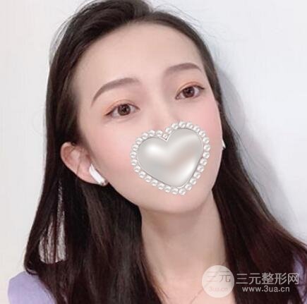 注射瘦脸果图