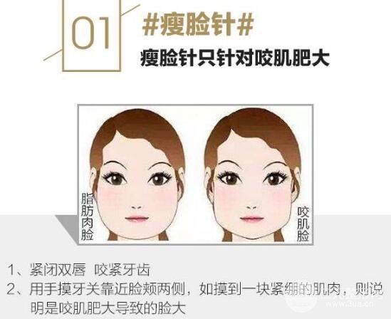 注意事项