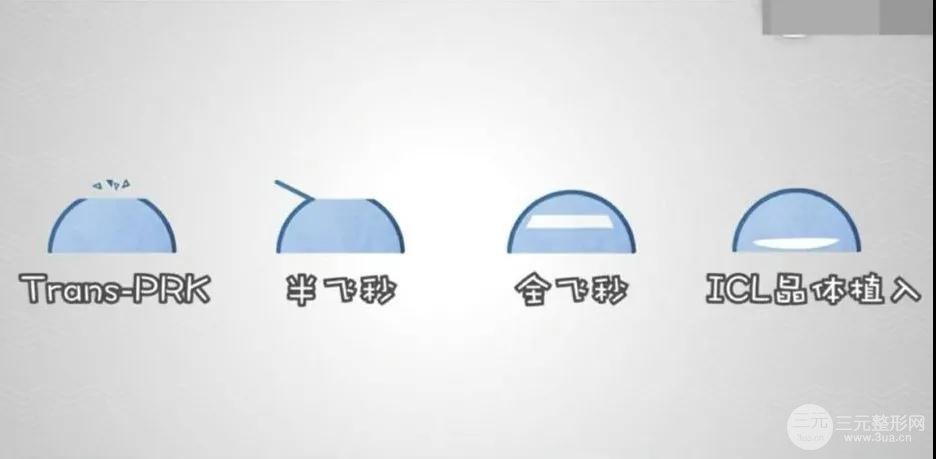 手术方式