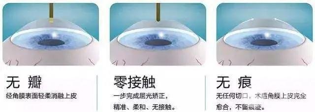 角膜厚度